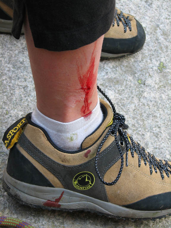 Anna got a small cut on her leg during the approach.  It bled all over her new shoes. (Category:  Rock Climbing)